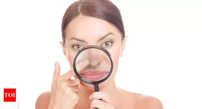Featured image for How to Get Rid of Blackheads and Whiteheads