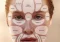 Featured image for Acne and Your Face: How to Treat Different Areas
