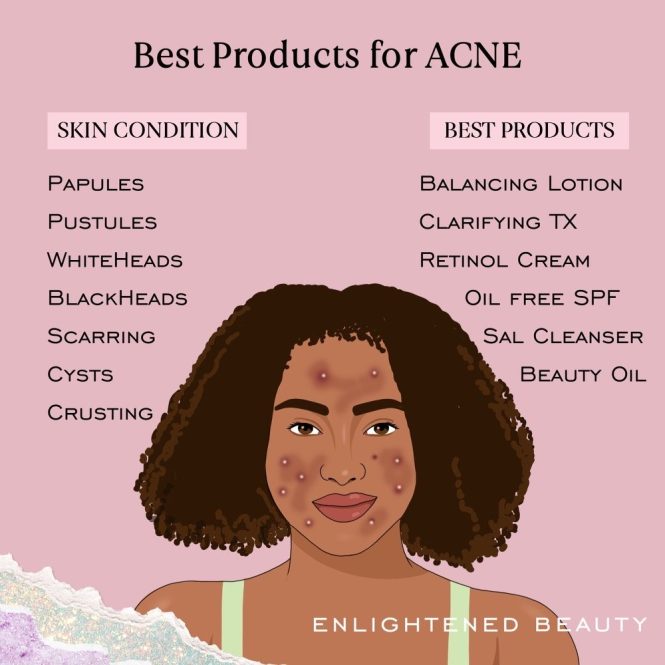 Featured image for The Best Beauty Products for Your Skin Type