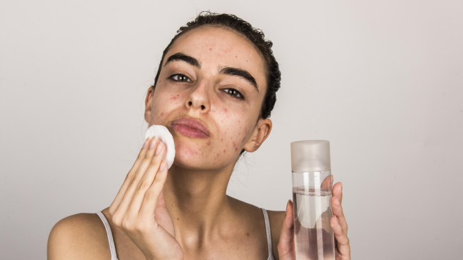 Featured image for Skincare for Acne-Prone Skin: How to Get Clear Skin