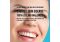 Featured image for Oral Hygiene Tips: How to Prevent Cavities and Gum Disease