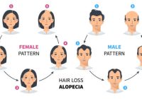 Featured image for Hair Loss in Women: Understanding the Causes and Solutions
