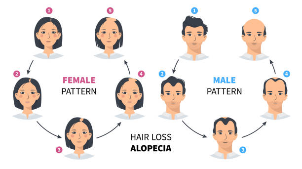 Featured image for Hair Loss in Women: Understanding the Causes and Solutions