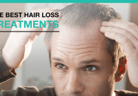 Featured image for Hair Loss Treatments: What You Need to Know Before Starting