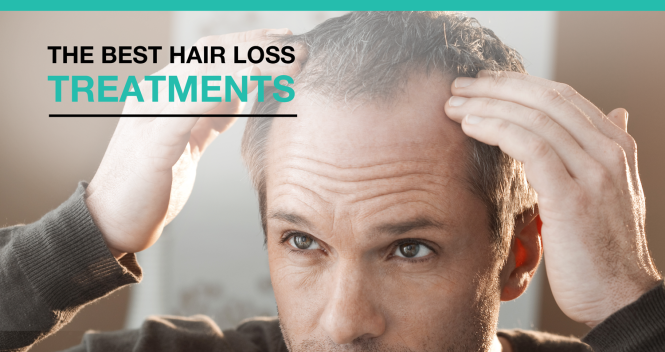 Featured image for Hair Loss Treatments: What You Need to Know Before Starting