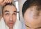 Featured image for The Truth About Hair Loss and Hair Washing: How Often Is Too Often?