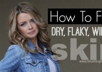 Featured image for The Ultimate Guide to Combatting Dry, Flaky Skin This Winter.