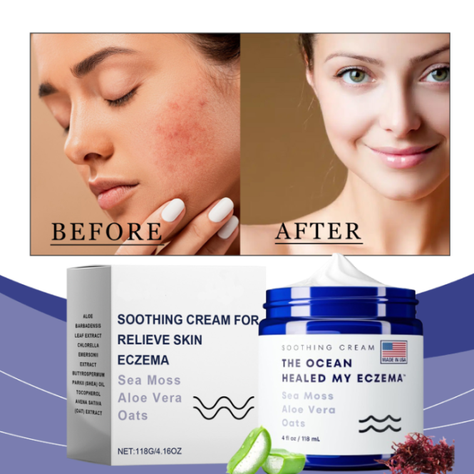 Featured image for Eczema Relief: Soothing Skincare Solutions for Sensitive Skin.