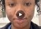 Featured image for Hyperpigmentation Solutions: Fading Dark Spots and Achieving Even Skin Tone.