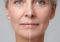 Featured image for Aging Gracefully: Skincare Tips for Mature Skin and Wrinkle Reduction.