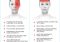 Featured image for New Hope for Migraine Sufferers: Innovative Treatments Explained.