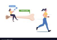 Featured image for Osteoporosis in Women: Prevention and Bone Health Tips.