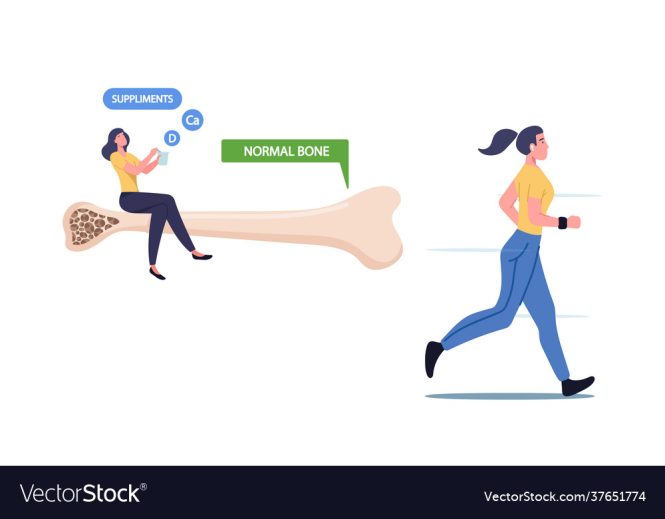 Featured image for Osteoporosis in Women: Prevention and Bone Health Tips.